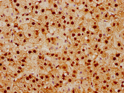 IHC image of CSB-RA022948A0HU diluted at 1:92.5 and staining in paraffin-embedded human adrenal gland tissue performed on a Leica BondTM system. After dewaxing and hydration, antigen retrieval was mediated by high pressure in a citrate buffer (pH 6.0). Section was blocked with 10% normal goat serum 30min at RT. Then primary antibody (1% BSA) was incubated at 4°C overnight. The primary is detected by a biotinylated secondary antibody and visualized using an HRP conjugated SP system. IHC image of CSB-RA022948A0HU diluted at 1:92.5 and staining in paraffin-embedded human adrenal gland tissue performed on a Leica BondTM system. After dewaxing and hydration, antigen retrieval was mediated by high pressure in a citrate buffer (pH 6.0). Section was blocked with 10% normal goat serum 30min at RT. Then primary antibody (1% BSA) was incubated at 4°C overnight. The primary is detected by a biotinylated secondary antibody and visualized using an HRP conjugated SP system.