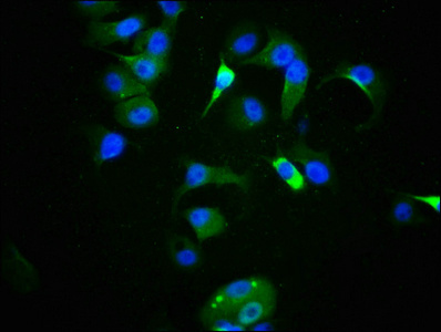 Immunofluorescence staining of MCF-7 cells with CSB-RA024077A09phHU at 1:100,counter-stained with DAPI. The cells were fixed in 4% formaldehyde, permeabilized using 0.2% Triton X-100 and blocked in 10% normal Goat Serum. The cells were then incubated with the antibody overnight at 4°C. The secondary antibody was Alexa Fluor 488-congugated AffiniPure Goat Anti-Rabbit IgG (H+L). Immunofluorescence staining of MCF-7 cells with CSB-RA024077A09phHU at 1:100,counter-stained with DAPI. The cells were fixed in 4% formaldehyde, permeabilized using 0.2% Triton X-100 and blocked in 10% normal Goat Serum. The cells were then incubated with the antibody overnight at 4°C. The secondary antibody was Alexa Fluor 488-congugated AffiniPure Goat Anti-Rabbit IgG (H+L).
