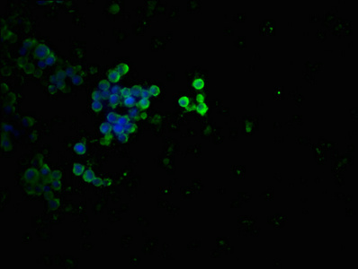 Immunofluorescence staining of 293 cells(treated with 50mM Calyculin A for 30min) with CSB-RA024077A55phHU at 1:100,counter-stained with DAPI. The cells were fixed in 4% formaldehyde, permeabilized using 0.2% Triton X-100 and blocked in 10% normal Goat Serum. The cells were then incubated with the antibody overnight at 4°C. The secondary antibody was Alexa Fluor 488-congugated AffiniPure Goat Anti-Rabbit IgG (H+L).