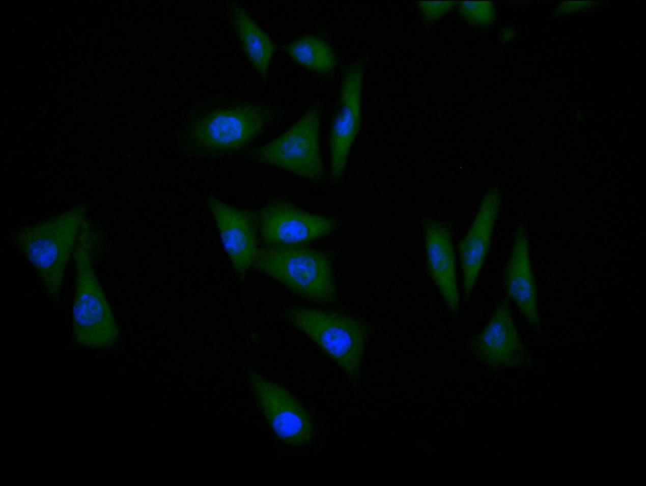 TP53 Recombinant Monoclonal Antibody - image 2