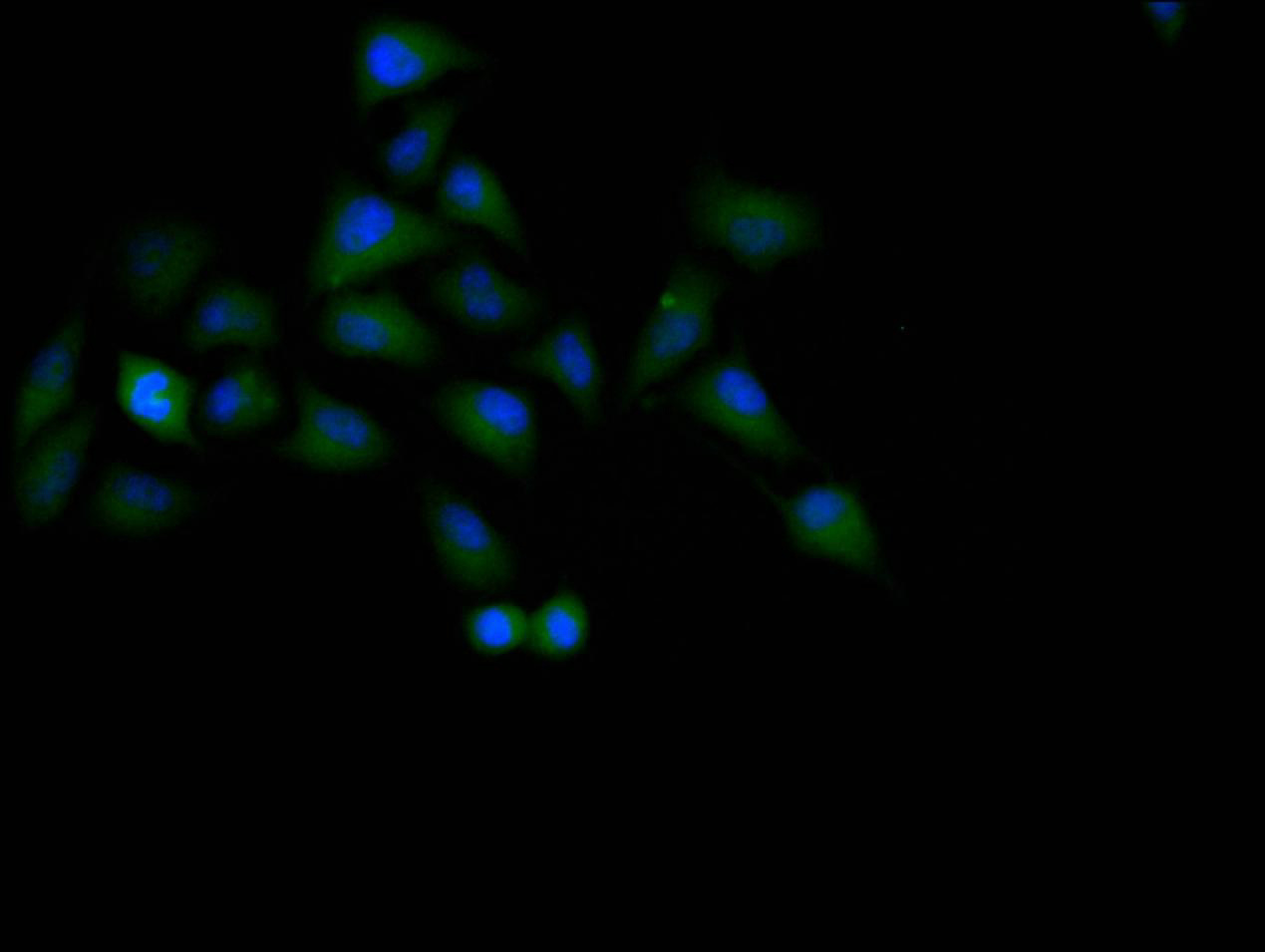 TP53 Recombinant Monoclonal Antibody - image 3