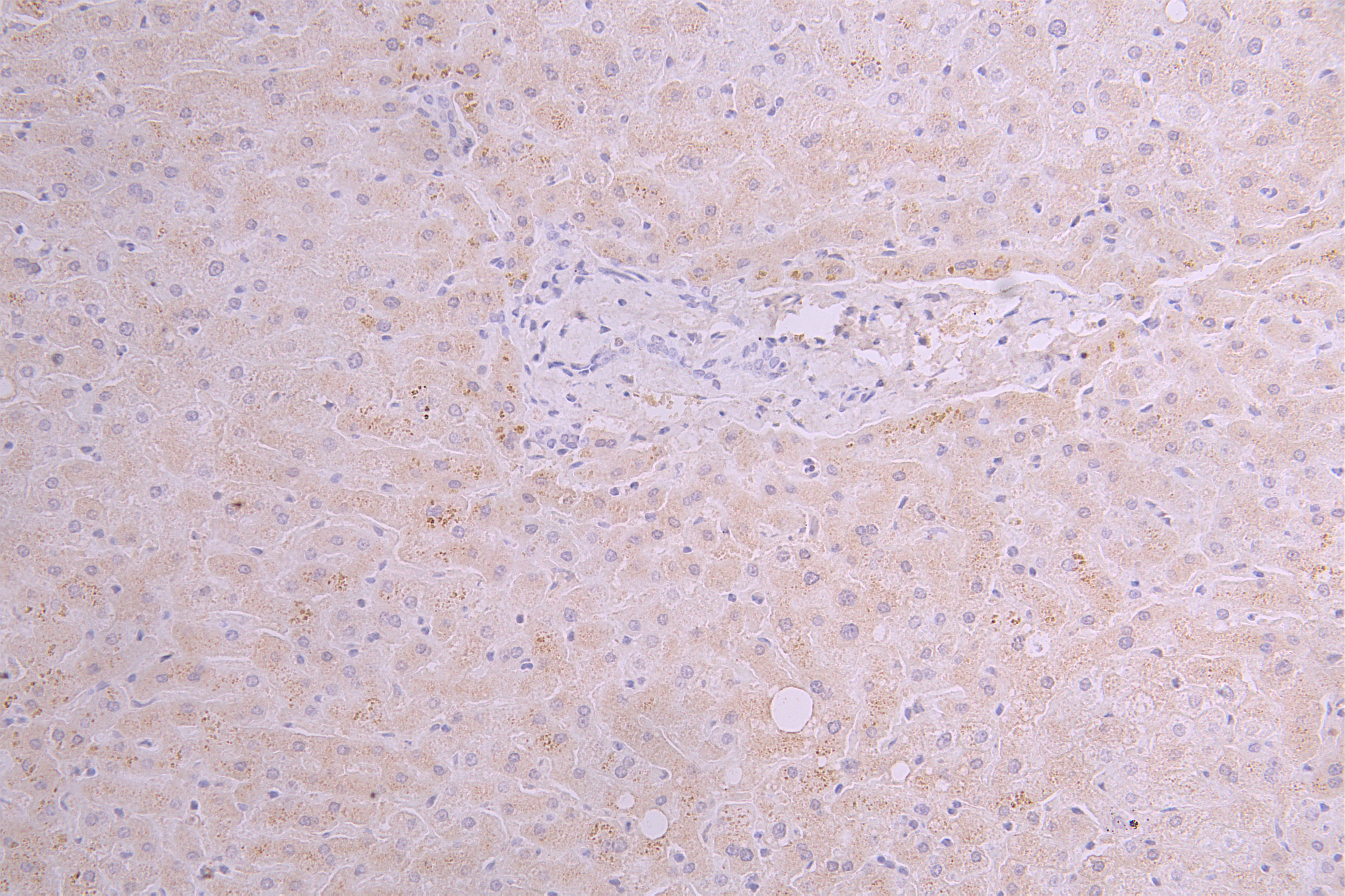 CSB-RA025141MA1HU