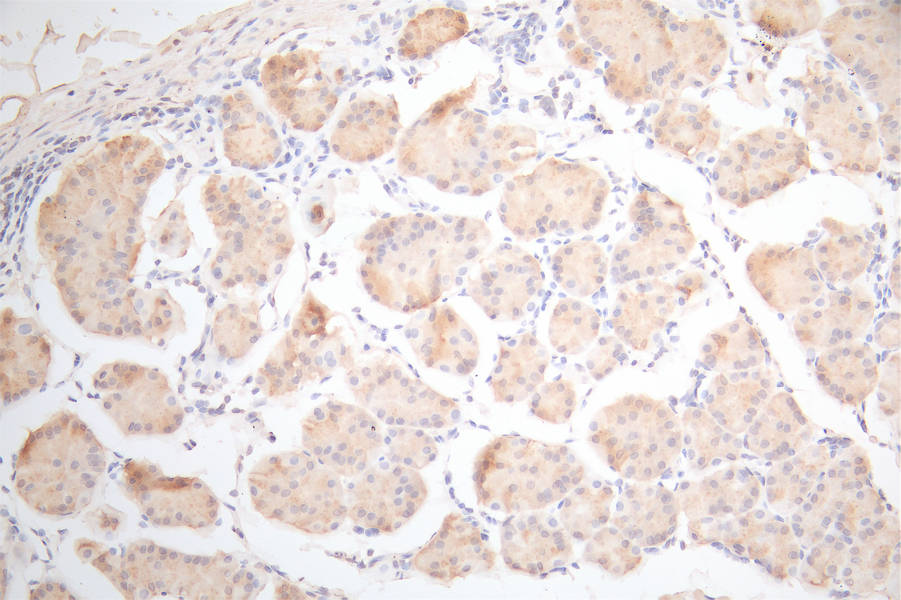 UBE2C Recombinant Monoclonal Antibody - image 2