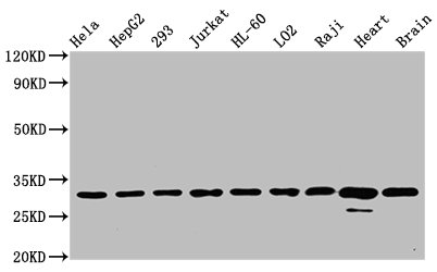 CSB-RA025821A0HU-WB