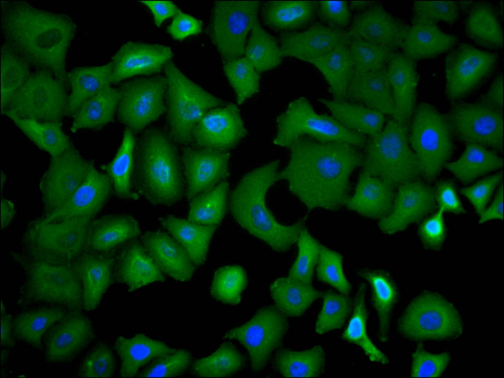 CSB-RA025833MA1HU