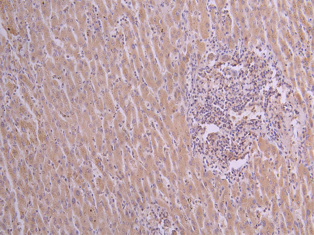 CSB-RA025833MA1HU