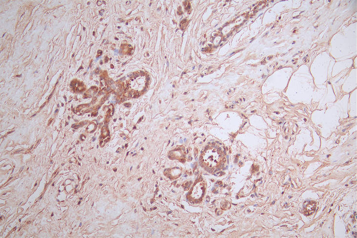 HSD3B1 Recombinant Monoclonal Antibody - image 2