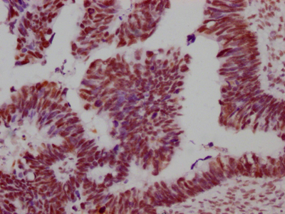 SMC1A Recombinant Monoclonal Antibody - image 2