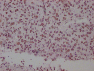 SMC1A Recombinant Monoclonal Antibody - image 3