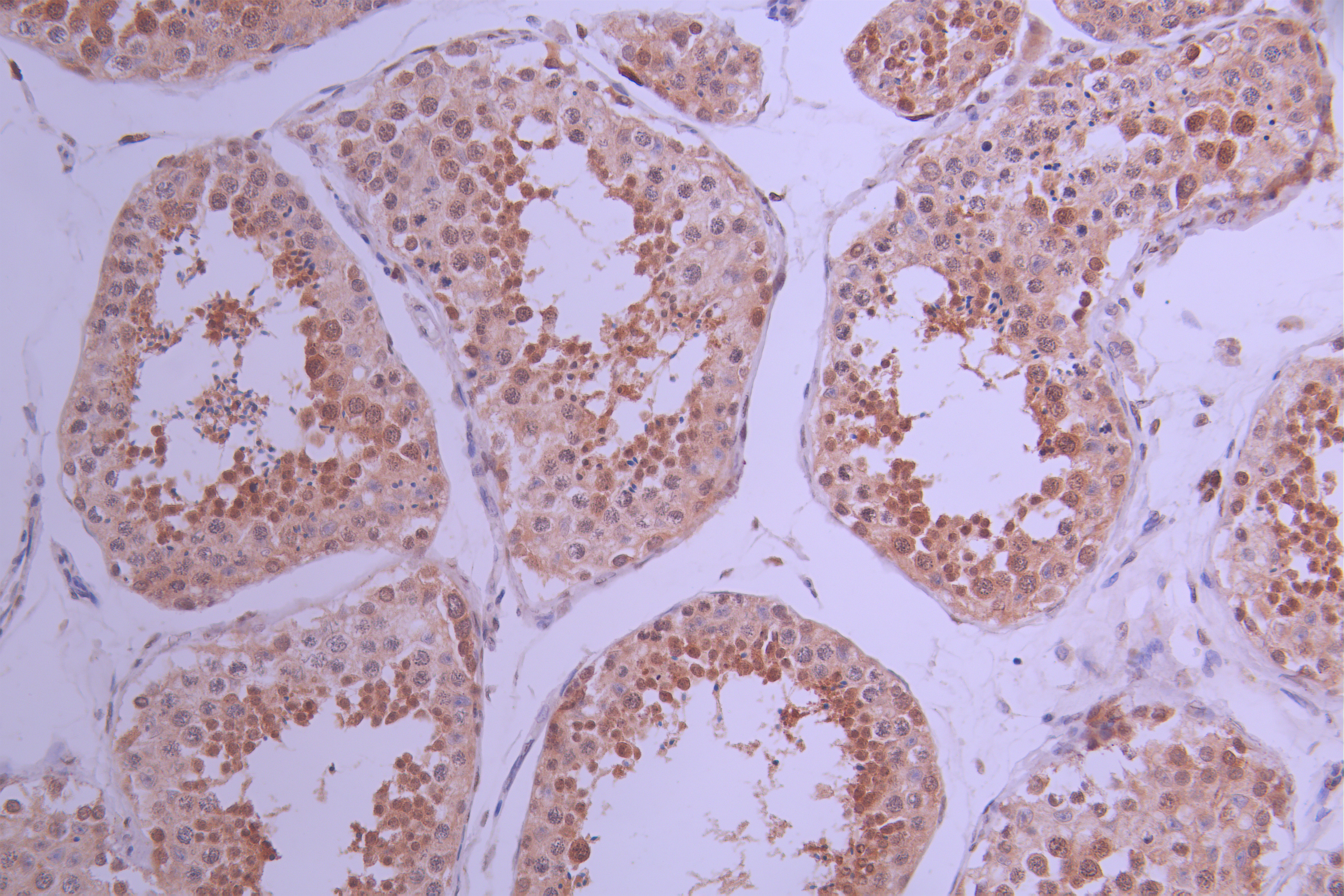 CSB-RA151186A0HU