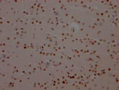 IHC image of CSB-RA152430A0HU diluted at 1:100 and staining in paraffin-embedded human brain tissue performed on a Leica BondTM system. After dewaxing and hydration, antigen retrieval was mediated by high pressure in a citrate buffer (pH 6.0). Section was blocked with 10% normal goat serum 30min at RT. Then primary antibody (1% BSA) was incubated at 4°C overnight. The primary is detected by a Goat anti-rabbit IgG polymer labeled by HRP and visualized using 0.05% DAB.