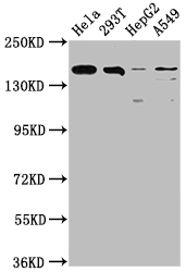 Western Blot Positive WB detected in: Hela whole cell lysate, 293T whole cell lysate, HepG2 whole cell lysate, A549 whole cell lysate All lanes: BRD4 antibody at 1:1500 Secondary Goat polyclonal to rabbit IgG at 1/50000 dilution Predicted band size: 153, 81, 89 kDa Observed band size: 153 kDa Western Blot Positive WB detected in: Hela whole cell lysate, 293T whole cell lysate, HepG2 whole cell lysate, A549 whole cell lysate All lanes: BRD4 antibody at 1:1500 Secondary Goat polyclonal to rabbit IgG at 1/50000 dilution Predicted band size: 153, 81, 89 kDa Observed band size: 153 kDa