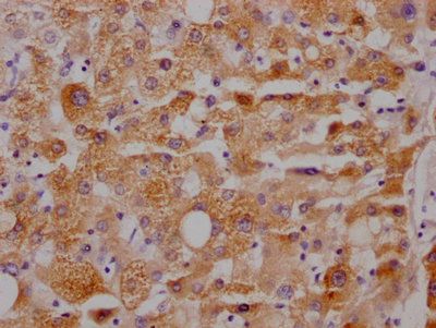 IHC image of CSB-RA153677A0HU diluted at 1:100 and staining in paraffin-embedded human liver tissue performed on a Leica BondTM system. After dewaxing and hydration, antigen retrieval was mediated by high pressure in a citrate buffer (pH 6.0). Section was blocked with 10% normal goat serum 30min at RT. Then primary antibody (1% BSA) was incubated at 4°C overnight. The primary is detected by a Goat anti-rabbit IgG polymer labeled by HRP and visualized using 0.05% DAB. IHC image of CSB-RA153677A0HU diluted at 1:100 and staining in paraffin-embedded human liver tissue performed on a Leica BondTM system. After dewaxing and hydration, antigen retrieval was mediated by high pressure in a citrate buffer (pH 6.0). Section was blocked with 10% normal goat serum 30min at RT. Then primary antibody (1% BSA) was incubated at 4°C overnight. The primary is detected by a Goat anti-rabbit IgG polymer labeled by HRP and visualized using 0.05% DAB.