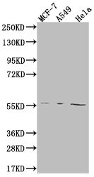 Western Blot Positive WB detected in: MCF-7 whole cell lysate, A549 whole cell lysate, Hela whole cell lysate All lanes: FADS1 antibody at 1:2000 Secondary Goat polyclonal to rabbit IgG at 1/50000 dilution Predicted band size: 52, 43 kDa Observed band size: 55 kDa