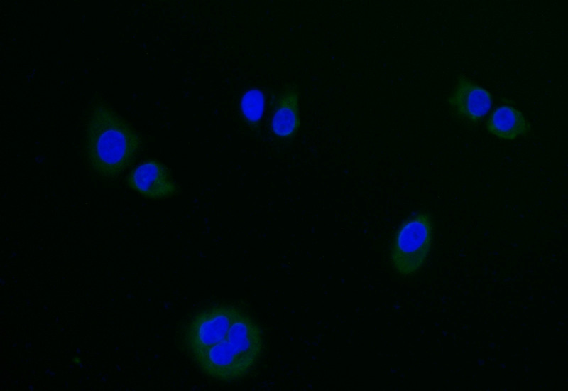 LGR6 Recombinant Monoclonal Antibody - image 2