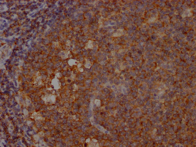 IHC image of CSB-RA157463A0HU diluted at 1:100 and staining in paraffin-embedded human tonsil tissue performed on a Leica BondTM system. After dewaxing and hydration, antigen retrieval was mediated by high pressure in a citrate buffer (pH 6.0). Section was blocked with 10% normal goat serum 30min at RT. Then primary antibody (1% BSA) was incubated at 4°C overnight. The primary is detected by a Goat anti-rabbit IgG polymer labeled by HRP and visualized using 0.05% DAB.