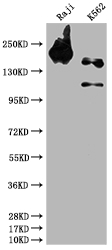 Western Blot Positive WB detected in: Raji whole cell lysate, K562 whole cell lysate All lanes: INPP5D antibody at 1:1500 Secondary Goat polyclonal to rabbit IgG at 1/50000 dilution Predicted band size: 134, 110 kDa Observed band size: 145 kDa Western Blot Positive WB detected in: Raji whole cell lysate, K562 whole cell lysate All lanes: INPP5D antibody at 1:1500 Secondary Goat polyclonal to rabbit IgG at 1/50000 dilution Predicted band size: 134, 110 kDa Observed band size: 145 kDa