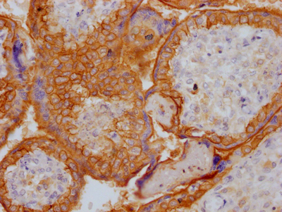 IHC image of CSB-RA159341A0HU diluted at 1:100 and staining in paraffin-embedded human placenta tissue performed on a Leica BondTM system. After dewaxing and hydration, antigen retrieval was mediated by high pressure in a citrate buffer (pH 6.0). Section was blocked with 10% normal goat serum 30min at RT. Then primary antibody (1% BSA) was incubated at 4°C overnight. The primary is detected by a Goat anti-rabbit IgG polymer labeled by HRP and visualized using 0.05% DAB.