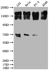 Western Blot Positive WB detected in: L02 whole cell lysate, Hela whole cell lysate, PC-3 whole cell lysate, A549 whole cell lysate All lanes: EGFR antibody at 1:2000 Secondary Goat polyclonal to rabbit IgG at 1/50000 dilution Predicted band size: 135, 45, 78, 70 kDa Observed band size: 165 kDa Western Blot Positive WB detected in: L02 whole cell lysate, Hela whole cell lysate, PC-3 whole cell lysate, A549 whole cell lysate All lanes: EGFR antibody at 1:2000 Secondary Goat polyclonal to rabbit IgG at 1/50000 dilution Predicted band size: 135, 45, 78, 70 kDa Observed band size: 165 kDa