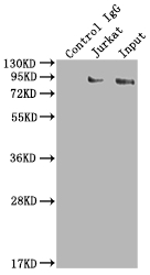 Immunoprecipitating SUZ12 in K562 whole cell lysate Lane 1: Rabbit control IgG instead of CSB-RA159561A0HU in K562 whole cell lysate. For western blotting,a HRP-conjugated Protein G antibody was used as the secondary antibody (1/2000) Lane 2: CSB-RA159561A0HU(2microg)+ K562 whole cell lysate(500microg) Lane 3: K562 whole cell lysate (10microg)