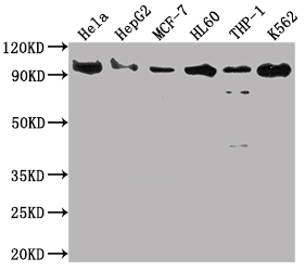 Western Blot Positive WB detected in: Hela whole cell lysate, HepG2 whole cell lysate, MCF-7 whole cell lysate, HL60 whole cell lysate, THP-1 whole cell lysate, K562 whole cell lysate All lanes: SUZ12 antibody at 1:2000 Secondary Goat polyclonal to rabbit IgG at 1/50000 dilution Predicted band size: 84 kDa Observed band size: 90 kDa Western Blot Positive WB detected in: Hela whole cell lysate, HepG2 whole cell lysate, MCF-7 whole cell lysate, HL60 whole cell lysate, THP-1 whole cell lysate, K562 whole cell lysate All lanes: SUZ12 antibody at 1:2000 Secondary Goat polyclonal to rabbit IgG at 1/50000 dilution Predicted band size: 84 kDa Observed band size: 90 kDa