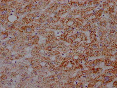 IHC image of CSB-RA159926A0HU diluted at 1:100 and staining in paraffin-embedded human liver tissue performed on a Leica BondTM system. After dewaxing and hydration, antigen retrieval was mediated by high pressure in a citrate buffer (pH 6.0). Section was blocked with 10% normal goat serum 30min at RT. Then primary antibody (1% BSA) was incubated at 4°C overnight. The primary is detected by a Goat anti-rabbit IgG polymer labeled by HRP and visualized using 0.05% DAB.