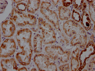 IHC image of CSB-RA159926A0HU diluted at 1:100 and staining in paraffin-embedded human kidney tissue performed on a Leica BondTM system. After dewaxing and hydration, antigen retrieval was mediated by high pressure in a citrate buffer (pH 6.0). Section was blocked with 10% normal goat serum 30min at RT. Then primary antibody (1% BSA) was incubated at 4°C overnight. The primary is detected by a Goat anti-rabbit IgG polymer labeled by HRP and visualized using 0.05% DAB.