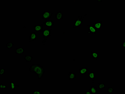 DNMT1 Recombinant Monoclonal Antibody - image 2
