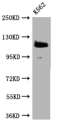 Western Blot Positive WB detected in: K562 whole cell lysate All lanes: PARP antibody at 1:2000 Secondary Goat polyclonal to rabbit IgG at 1/50000 dilution Predicted band size: 114 kDa Observed band size: 114 kDa Western Blot Positive WB detected in: K562 whole cell lysate All lanes: PARP antibody at 1:2000 Secondary Goat polyclonal to rabbit IgG at 1/50000 dilution Predicted band size: 114 kDa Observed band size: 114 kDa