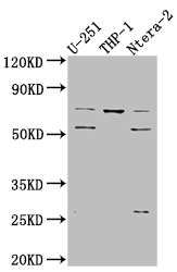 Western Blot Positive WB detected in: U-251 whole cell lysate, THP-1 whole cell lysate, Ntera-2 whole cell lysate All lanes: PTH1R antibody at 1:1000 Secondary Goat polyclonal to rabbit IgG at 1/50000 dilution Predicted band size: 67 kDa Observed band size: 72, 55 kDa Western Blot Positive WB detected in: U-251 whole cell lysate, THP-1 whole cell lysate, Ntera-2 whole cell lysate All lanes: PTH1R antibody at 1:1000 Secondary Goat polyclonal to rabbit IgG at 1/50000 dilution Predicted band size: 67 kDa Observed band size: 72, 55 kDa