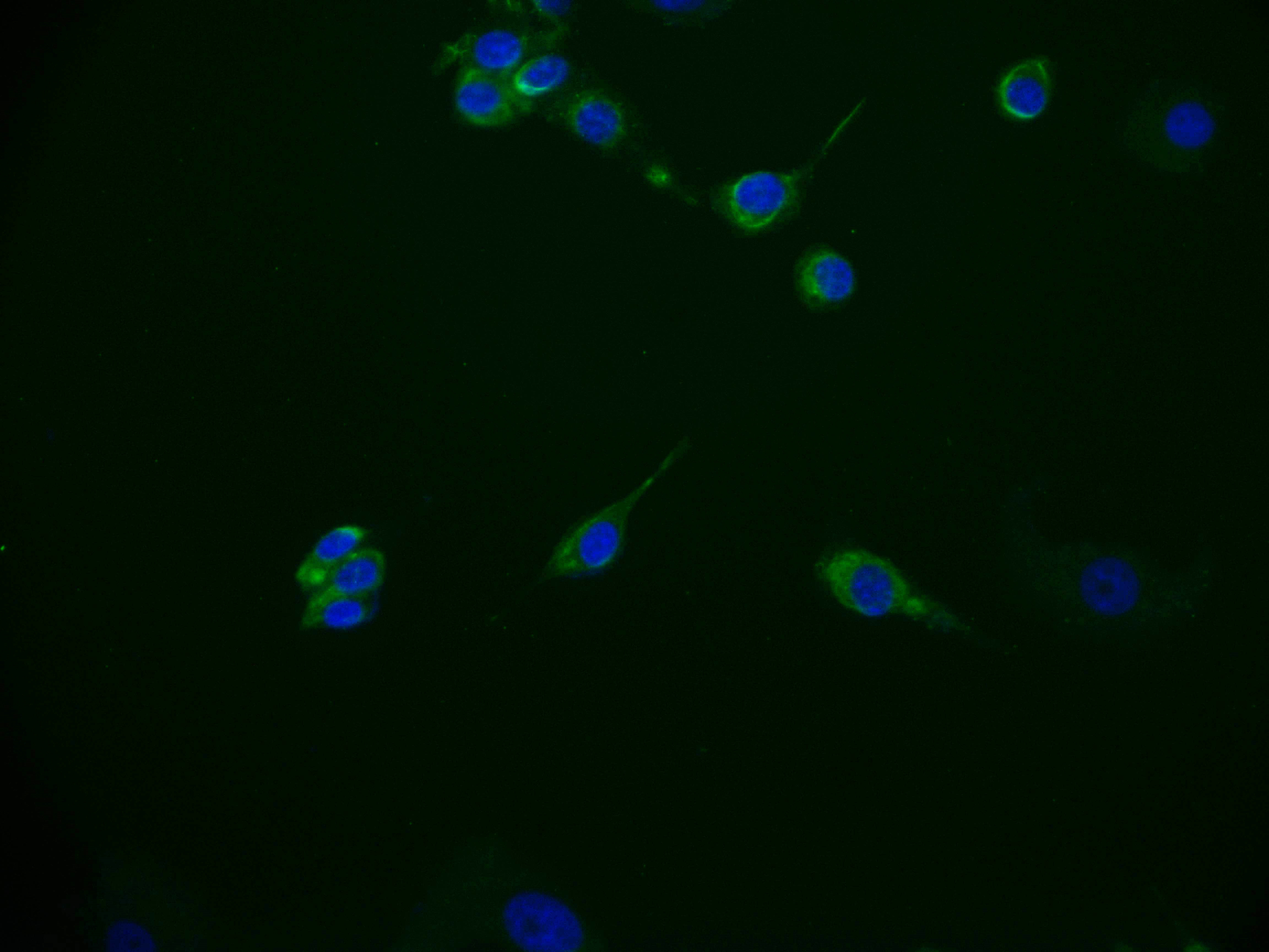 Immunofluorescence staining of MCF-7 cell with CSB-RA172768A0HU at 1:50, counter-stained with DAPI. The cells were fixed in 4% formaldehyde and blocked in 10% normal Goat Serum. The cells were then incubated with the antibody overnight at 4°C. The secondary antibody was Alexa Fluor 536-congugated AffiniPure Goat Anti-Rabbit IgG(H+L). Immunofluorescence staining of MCF-7 cell with CSB-RA172768A0HU at 1:50, counter-stained with DAPI. The cells were fixed in 4% formaldehyde and blocked in 10% normal Goat Serum. The cells were then incubated with the antibody overnight at 4°C. The secondary antibody was Alexa Fluor 536-congugated AffiniPure Goat Anti-Rabbit IgG(H+L).