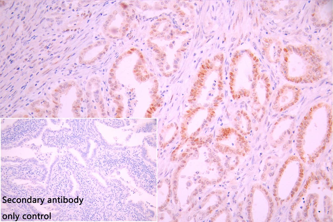 CSB-RA172909A0HU