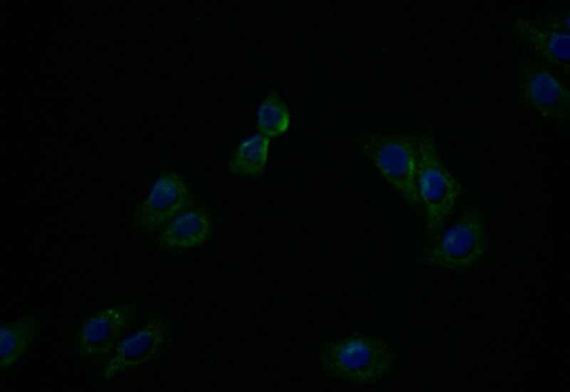 ATP7B Recombinant Monoclonal Antibody - image 3