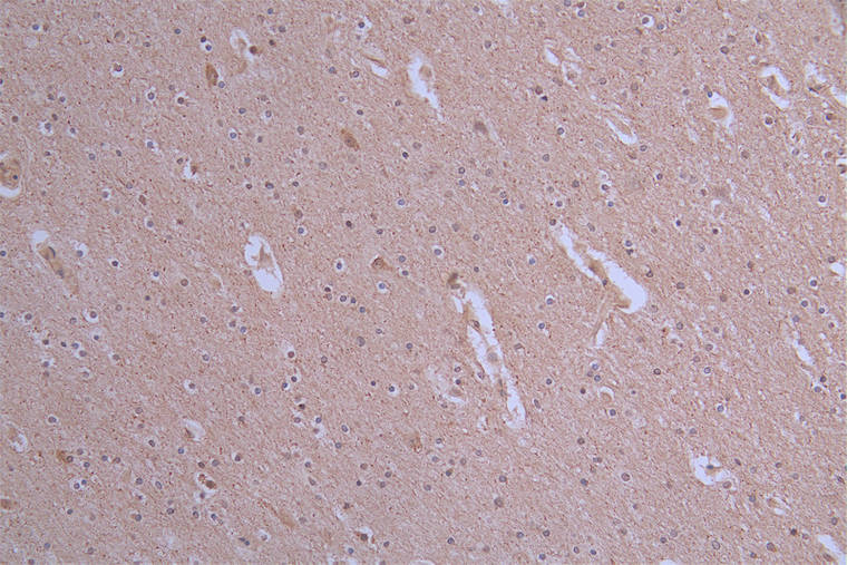 CSB-RA175460A0HU IHC1