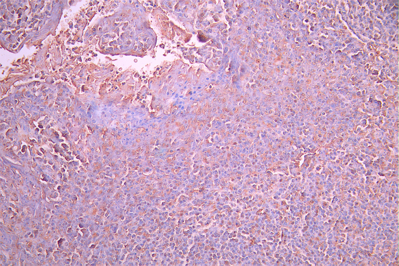 CSB-RA175604A0HU