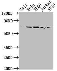 Western Blot Positive WB detected in: Raji whole cell lysate, Hela whole cell lysate, HL60 whole cell lysate, Jurkat whole cell lysate, A549 whole cell lysate All lanes: PRMT5 antibody at 1:2000 Secondary Goat polyclonal to rabbit IgG at 1/50000 dilution Predicted band size: 73, 72, 54, 68, 67 kDa Observed band size: 73 kDa