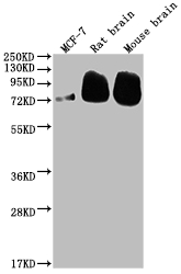 Western Blot Positive WB detected in: MCF-7 whole cell lysate, Rat brain tissue, Mouse brain tissue All lanes: BACE1 antibody at 1:2000 Secondary Goat polyclonal to rabbit IgG at 1/50000 dilution Predicted band size: 56, 53, 52, 49, 46, 43 kDa Observed band size: 72 kDa Western Blot Positive WB detected in: MCF-7 whole cell lysate, Rat brain tissue, Mouse brain tissue All lanes: BACE1 antibody at 1:2000 Secondary Goat polyclonal to rabbit IgG at 1/50000 dilution Predicted band size: 56, 53, 52, 49, 46, 43 kDa Observed band size: 72 kDa