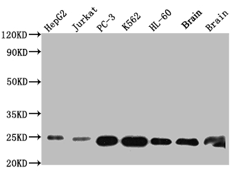 Western Blot Positive WB detected in: HepG2 whole cell lysate, Jurkat whole cell lysate, PC-3 whole cell lysate, K562 whole cell lysate, HL-60 whole cell lysate, Mouse Brain whole cell lysate, Rat Brain whole cell lysate All lanes: GSTP1 antibody at 1:1000 Secondary Goat polyclonal to rabbit IgG at 1/50000 dilution Predicted band size: 24 kDa Observed band size: 24 kDa Western Blot Positive WB detected in: HepG2 whole cell lysate, Jurkat whole cell lysate, PC-3 whole cell lysate, K562 whole cell lysate, HL-60 whole cell lysate, Mouse Brain whole cell lysate, Rat Brain whole cell lysate All lanes: GSTP1 antibody at 1:1000 Secondary Goat polyclonal to rabbit IgG at 1/50000 dilution Predicted band size: 24 kDa Observed band size: 24 kDa
