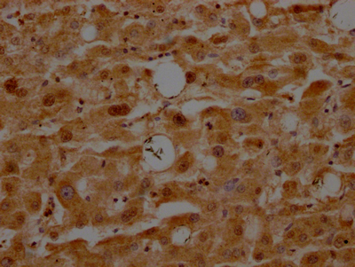 IHC image of CSB-RA180846A0HU diluted at 1:100 and staining in paraffin-embedded human liver tissue performed on a Leica BondTM system. After dewaxing and hydration, antigen retrieval was mediated by high pressure in a citrate buffer (pH 6.0). Section was blocked with 10% normal goat serum 30min at RT. Then primary antibody (1% BSA) was incubated at 4°C overnight. The primary is detected by a Goat anti-rabbit IgG polymer labeled by HRP and visualized using 0.05% DAB.