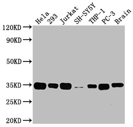 Western Blot Positive WB detected in: Hela whole cell lysate, 293 whole cell lysate, Jurkat whole cell lysate, SH-SY5Y whole cell lysate, THP-1 whole cell lysate, PC-3 whole cell lysate, Rat brain tissue All lanes: ATF5 antibody at 1:2000 Secondary Goat polyclonal to rabbit IgG at 1/50000 dilution Predicted band size: 31 kDa Observed band size: 35 kDa Western Blot Positive WB detected in: Hela whole cell lysate, 293 whole cell lysate, Jurkat whole cell lysate, SH-SY5Y whole cell lysate, THP-1 whole cell lysate, PC-3 whole cell lysate, Rat brain tissue All lanes: ATF5 antibody at 1:2000 Secondary Goat polyclonal to rabbit IgG at 1/50000 dilution Predicted band size: 31 kDa Observed band size: 35 kDa