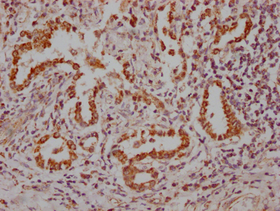 IHC image of CSB-RA181189A0HU diluted at 1:100 and staining in paraffin-embedded human lung tissue performed on a Leica BondTM system. After dewaxing and hydration, antigen retrieval was mediated by high pressure in a citrate buffer (pH 6.0). Section was blocked with 10% normal goat serum 30min at RT. Then primary antibody (1% BSA) was incubated at 4°C overnight. The primary is detected by a Goat anti-rabbit IgG polymer labeled by HRP and visualized using 0.05% DAB.