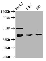 Western Blot Positive WB detected in: HepG2 whole cell lysate, U251 whole cell lysate, U87 whole cell lysate All lanes: TTF1 antibody at 1:2000 Secondary Goat polyclonal to rabbit IgG at 1/50000 dilution Predicted band size: 39 kDa Observed band size: 39 kDa Western Blot Positive WB detected in: HepG2 whole cell lysate, U251 whole cell lysate, U87 whole cell lysate All lanes: TTF1 antibody at 1:2000 Secondary Goat polyclonal to rabbit IgG at 1/50000 dilution Predicted band size: 39 kDa Observed band size: 39 kDa
