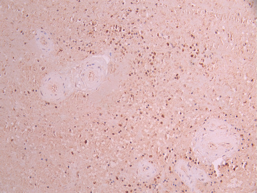 CSB-RA183183A0HU