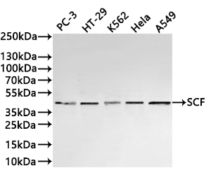 CSB-RA183183A0HU