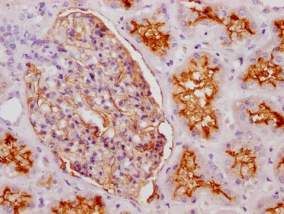 IHC image of CSB-RA187479A0HU diluted at 1:100 and staining in paraffin-embedded human kidney tissue performed on a Leica BondTM system. After dewaxing and hydration, antigen retrieval was mediated by high pressure in a citrate buffer (pH 6.0). Section was blocked with 10% normal goat serum 30min at RT. Then primary antibody (1% BSA) was incubated at 4°C overnight. The primary is detected by a Goat anti-rabbit IgG polymer labeled by HRP and visualized using 0.05% DAB. IHC image of CSB-RA187479A0HU diluted at 1:100 and staining in paraffin-embedded human kidney tissue performed on a Leica BondTM system. After dewaxing and hydration, antigen retrieval was mediated by high pressure in a citrate buffer (pH 6.0). Section was blocked with 10% normal goat serum 30min at RT. Then primary antibody (1% BSA) was incubated at 4°C overnight. The primary is detected by a Goat anti-rabbit IgG polymer labeled by HRP and visualized using 0.05% DAB.