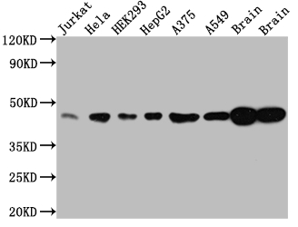 Western Blot Positive WB detected in: Jurkat whole cell lysate, Hela whole cell lysate, HEK293 whole cell lysate, HepG2 whole cell lysate, A375 whole cell lysate, A549 whole cell lysate, Rat Brain whole cell lysate, Mouse Brain whole cell lysate All lanes: ERK2 antibody at 1:1000 Secondary Goat polyclonal to rabbit IgG at 1/50000 dilution Predicted band size: 42, 37 kDa Observed band size: 42 kDa Western Blot Positive WB detected in: Jurkat whole cell lysate, Hela whole cell lysate, HEK293 whole cell lysate, HepG2 whole cell lysate, A375 whole cell lysate, A549 whole cell lysate, Rat Brain whole cell lysate, Mouse Brain whole cell lysate All lanes: ERK2 antibody at 1:1000 Secondary Goat polyclonal to rabbit IgG at 1/50000 dilution Predicted band size: 42, 37 kDa Observed band size: 42 kDa