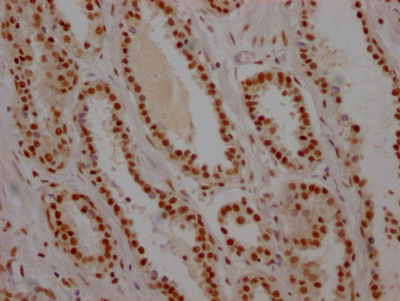 CSB-RA192026A0HU