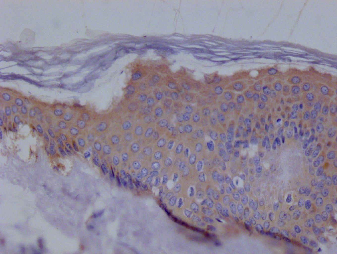 IHC image of CSB-RA194531A0HU diluted at 1:100 and staining in paraffin-embedded human skin tissue performed on a Leica BondTM system. After dewaxing and hydration, antigen retrieval was mediated by high pressure in a citrate buffer (pH 6.0). Section was blocked with 10% normal goat serum 30min at RT. Then primary antibody (1% BSA) was incubated at 4°C overnight. The primary is detected by a Goat anti-rabbit polymer IgG labeled by HRP and visualized using 0.05% DAB. IHC image of CSB-RA194531A0HU diluted at 1:100 and staining in paraffin-embedded human skin tissue performed on a Leica BondTM system. After dewaxing and hydration, antigen retrieval was mediated by high pressure in a citrate buffer (pH 6.0). Section was blocked with 10% normal goat serum 30min at RT. Then primary antibody (1% BSA) was incubated at 4°C overnight. The primary is detected by a Goat anti-rabbit polymer IgG labeled by HRP and visualized using 0.05% DAB.