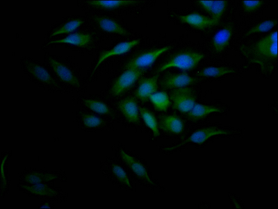 Immunofluorescence staining of Hela Cells with CSB-RA204558A0HU at 1:50, counter-stained with DAPI. The cells were fixed in 4% formaldehyde, permeated by 0.2% TritonX-100, and blocked in 10% normal Goat Serum. The cells were then incubated with the antibody overnight at 4°C. Nuclear DNA was labeled in blue with DAPI. The secondary antibody was FITC-conjugated AffiniPure Goat Anti-Rabbit IgG (H+L). Immunofluorescence staining of Hela Cells with CSB-RA204558A0HU at 1:50, counter-stained with DAPI. The cells were fixed in 4% formaldehyde, permeated by 0.2% TritonX-100, and blocked in 10% normal Goat Serum. The cells were then incubated with the antibody overnight at 4°C. Nuclear DNA was labeled in blue with DAPI. The secondary antibody was FITC-conjugated AffiniPure Goat Anti-Rabbit IgG (H+L).