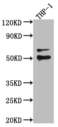 Western Blot Positive WB detected in: A549 whole cell lysate, U-251 whole cell lysate, Hela whole cell lysate All lanes: FLI1 antibody at 1:1000 Secondary Goat polyclonal to rabbit IgG at 1/50000 dilution Predicted band size: 51, 44, 48, 30 kDa Observed band size: 51 kDa Western Blot Positive WB detected in: A549 whole cell lysate, U-251 whole cell lysate, Hela whole cell lysate All lanes: FLI1 antibody at 1:1000 Secondary Goat polyclonal to rabbit IgG at 1/50000 dilution Predicted band size: 51, 44, 48, 30 kDa Observed band size: 51 kDa